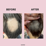 GLOWWA Hair Food Supplement